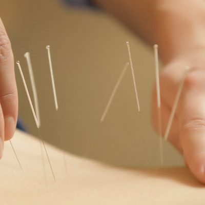 acupuntura-cover-crop